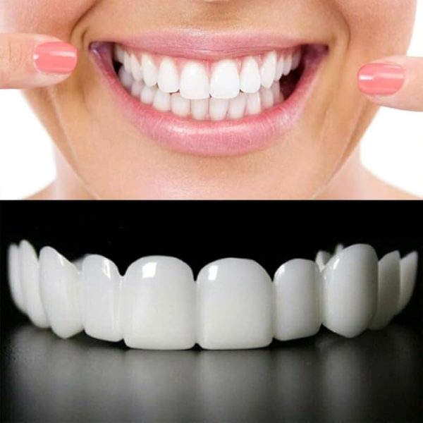 Snap-on Smile For Beautiful Smiles